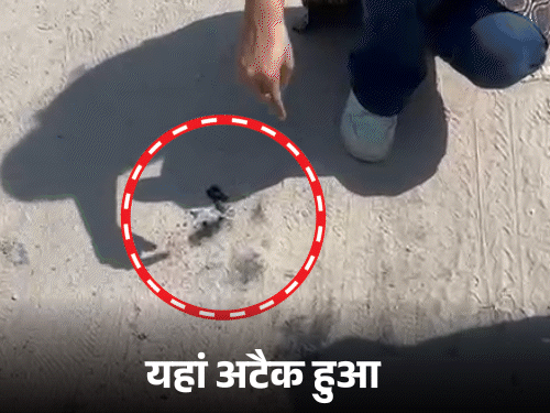 क्या अफेयर में नर्स पर फेंका गया एसिड?:मेरठ में बोतल पर मिले फिंगर प्रिंट; पुलिस की जांच 3 एंगल पर