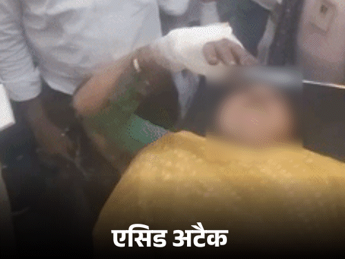 नर्स पर एसिड अटैक करवाने वाले का एनकाउंटर:मेरठ में वारदात के लिए नाबालिग को चुना, लव अफेयर में लिया बदला