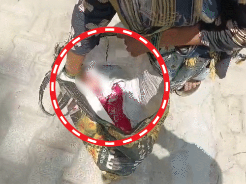 पिता झोले में नवजात का शव लेकर कलेक्ट्रेट पहुंचा:बोला- डॉक्टरों ने बच्चे की जान ली; लखीमपुर CMO ने अस्पताल सील कराया